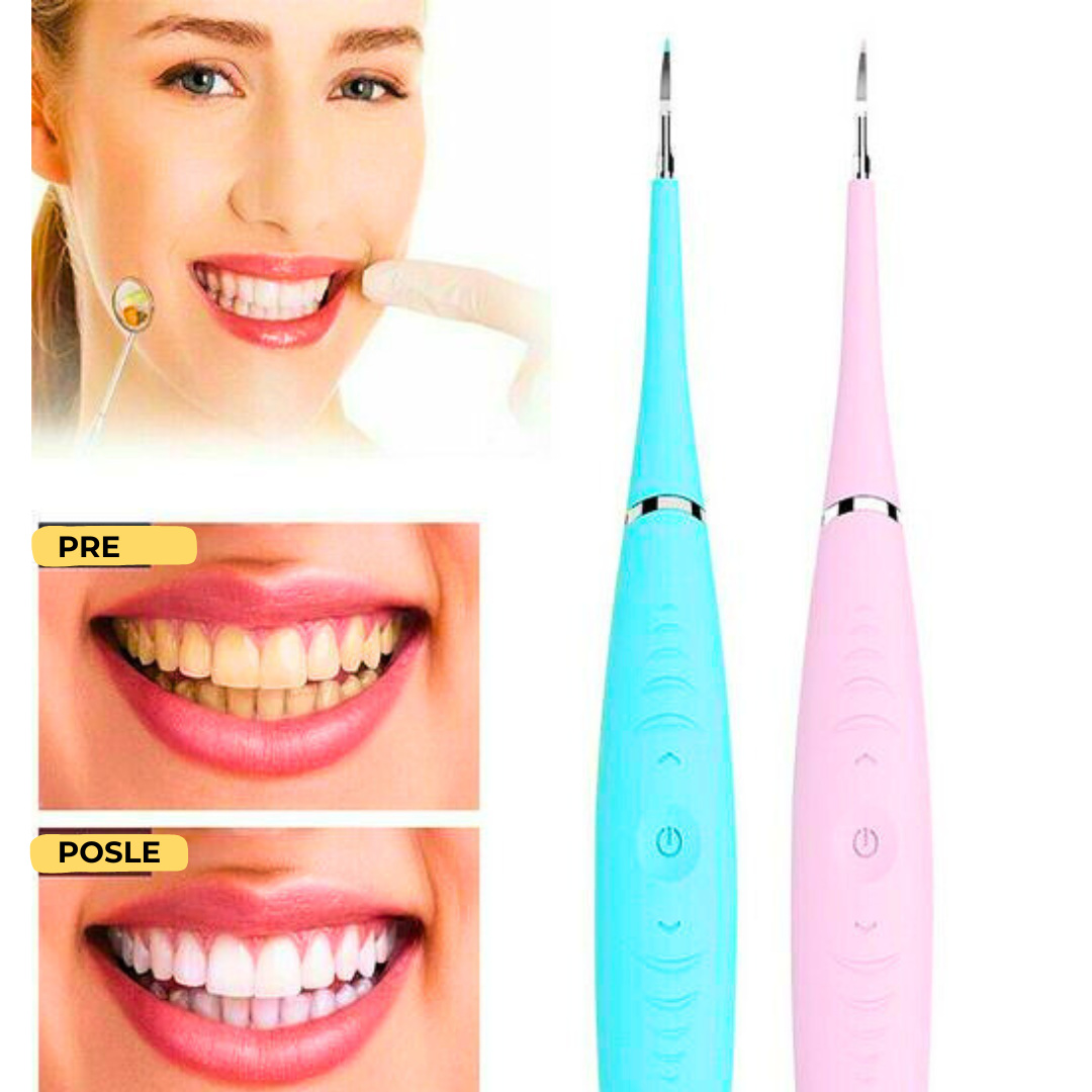 Električni Skidač Kamenca za Zube – USB Punjenje | Precizno i Bezbedno Čišćenje