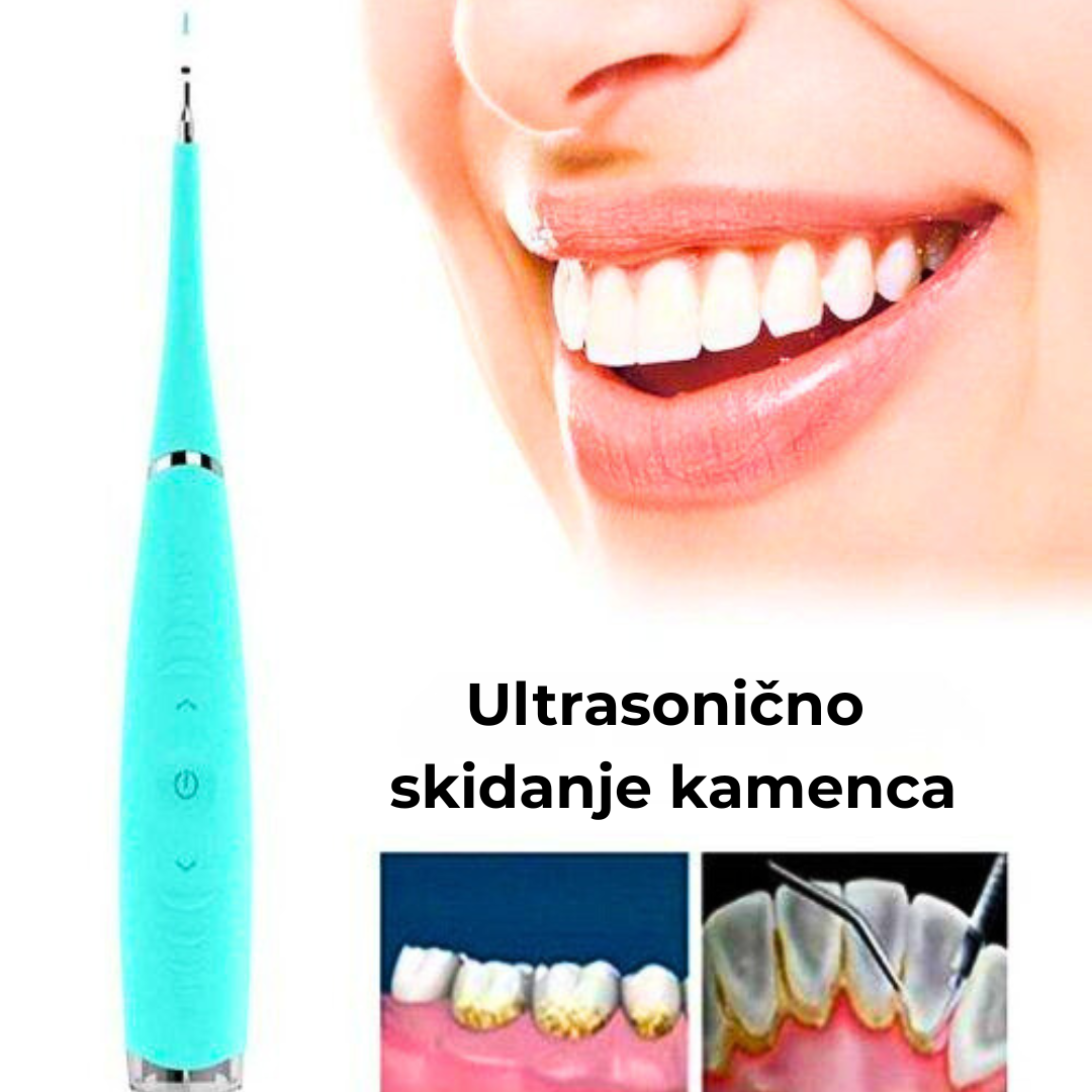 Električni Skidač Kamenca za Zube – USB Punjenje | Precizno i Bezbedno Čišćenje