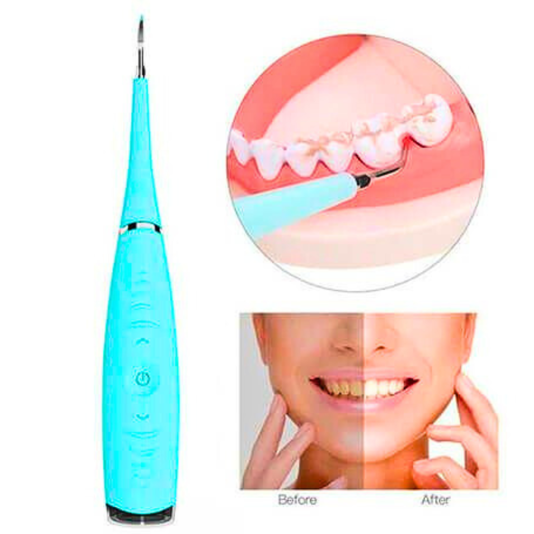 Električni Skidač Kamenca za Zube – USB Punjenje | Precizno i Bezbedno Čišćenje
